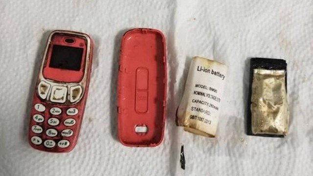  Homem passa por procedimento de emergência após engolir um celular Nokia antigo